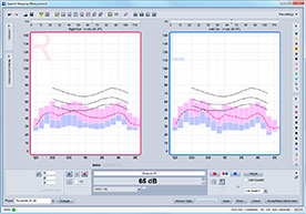 Mit dieser Ansicht können Sie die dynamische Bandbreite von Live-Signalen, die von einem Hörsystem verarbeitet werden, grafisch darstellen und analysieren. Die Analysemöglichkeiten umfassen das gesamte Spektrum von Breitbandsignalen. Die Perzentilanalyse unterstützt Sie zudem bei der Einstellung des Hörsystems hinsichtlich lauter und leiser Elemente eines Sprachsignals.